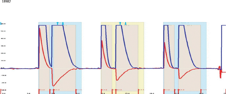 Propranolol on Lux 5 µm Cellulose-1 by Chiral SFC with EtOH dissolution solvent