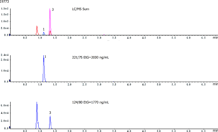 EtS EtG Sample #3 medium levels