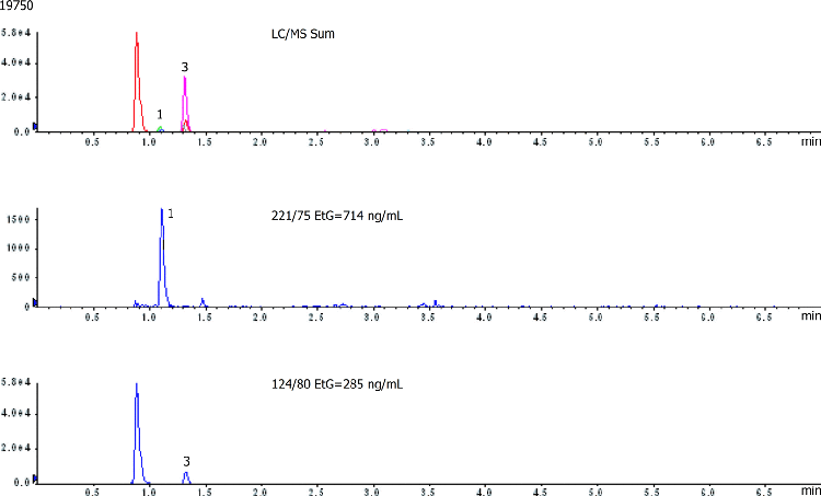 EtG and EtS in Urine by LC/MS/MS