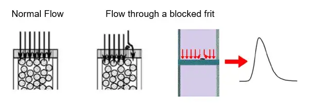 HPLC column lifetime - high backpressure