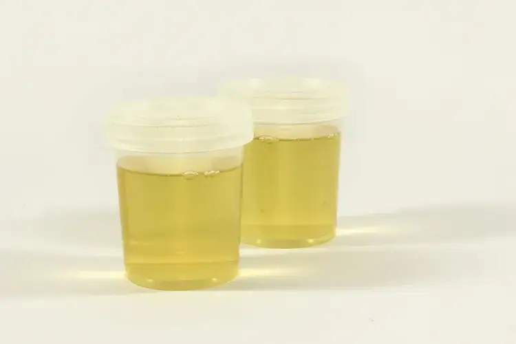 Urine test